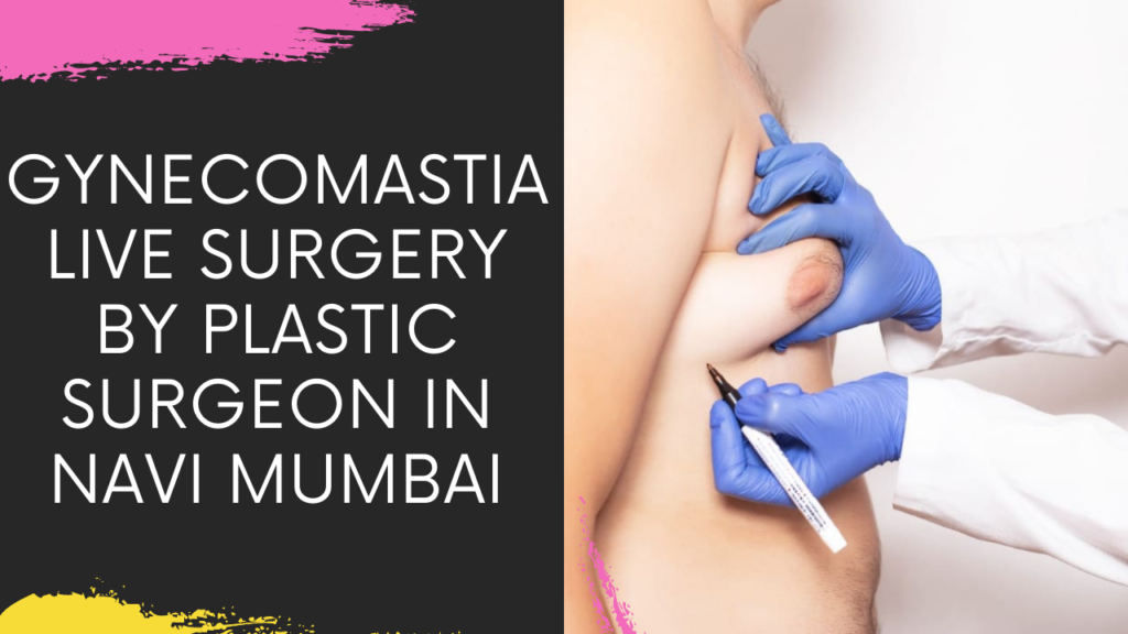 Professional Gynecomastia Treatment in Navi Mumbai for male patients seeking relief.