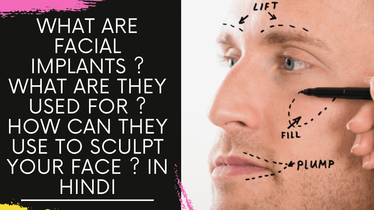 Read more about the article What are Facial Implants ? what are they used for ? How can they use to sculpt your face ?