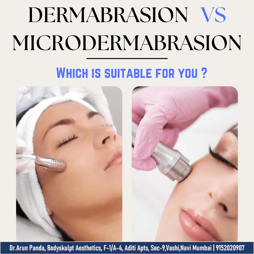 You are currently viewing Dermabrasion vs Microdermabrasion? Explained by Dr. Arun Panda