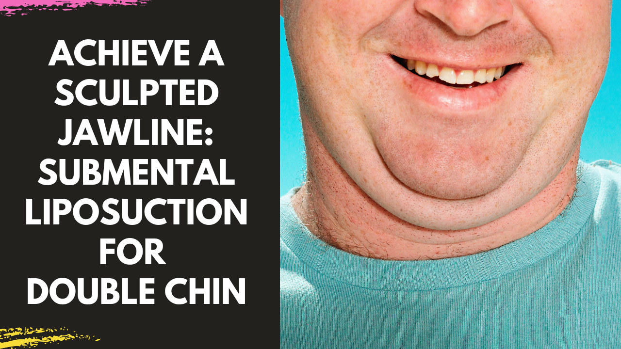 You are currently viewing Achieve a Sculpted Jawline: Submental Liposuction for Double Chin in Mumbai by Dr Arun Panda