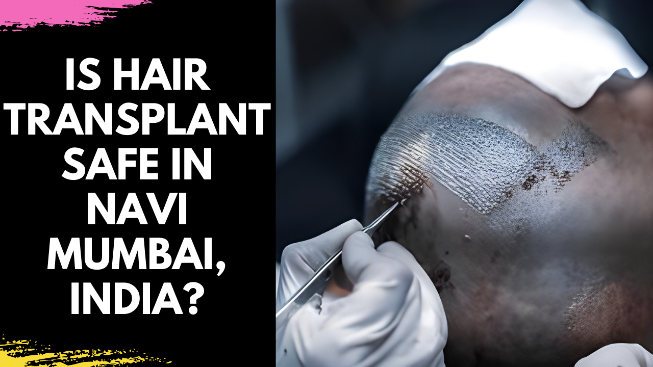 Read more about the article Is Hair Transplant Safe in Navi Mumbai, India?
