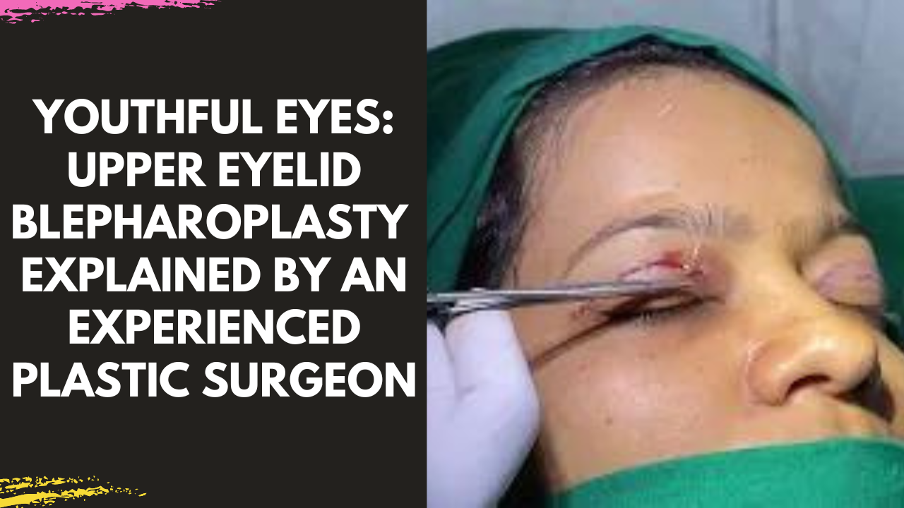 Read more about the article Upper Eyelid Blepharoplasty by Dr Arun Panda Facial Plastic Surgeon