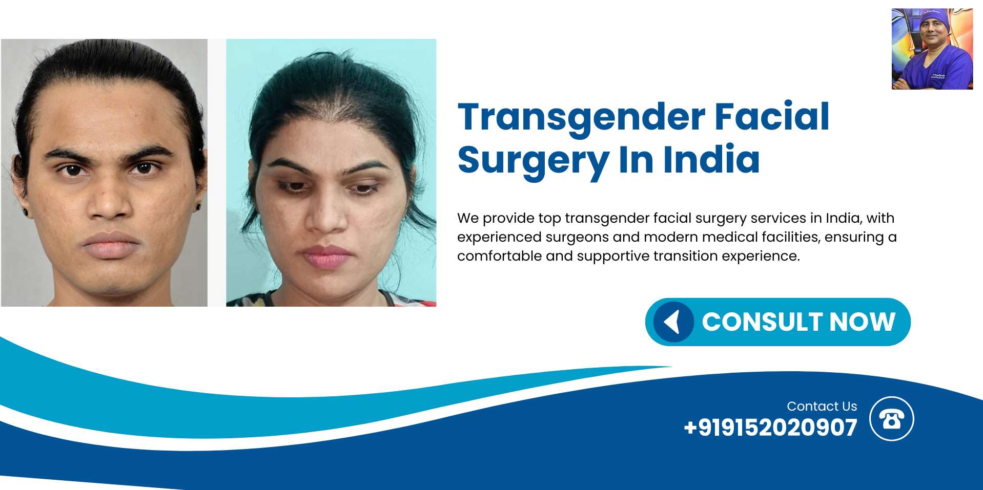 Before and after images showing the results of Facial Feminization Surgery demonstrating facial transformation.